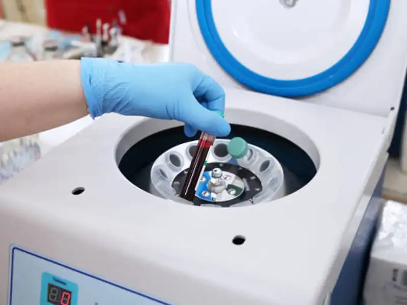 Plasma-Rico-en-Plaquetas-1